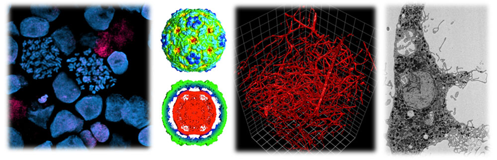 Four sample images from the Penn State College of Medicine Microscopy Imaging Facility are seen in a collage. The first image is of blue items on a black background; the second is of two round green images stacked atop one another on a white background; the third is of a series of tangled red strands overlaid on a 3-D grid on a black background; and the fourth is of a dark gray shape on a light gray background.