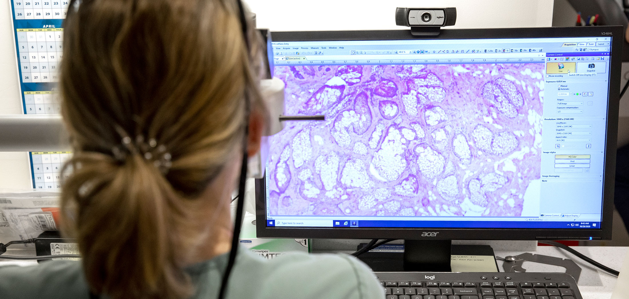 Ami Greene, a fellow in the Department of Dermatology, looks over skin samples using the Olympus digital imagers in the Mohs lab in October 2020. The back of her head is visible, with her hair in a ponytail, and a microscopic image is seen on a computer  screen next to her.