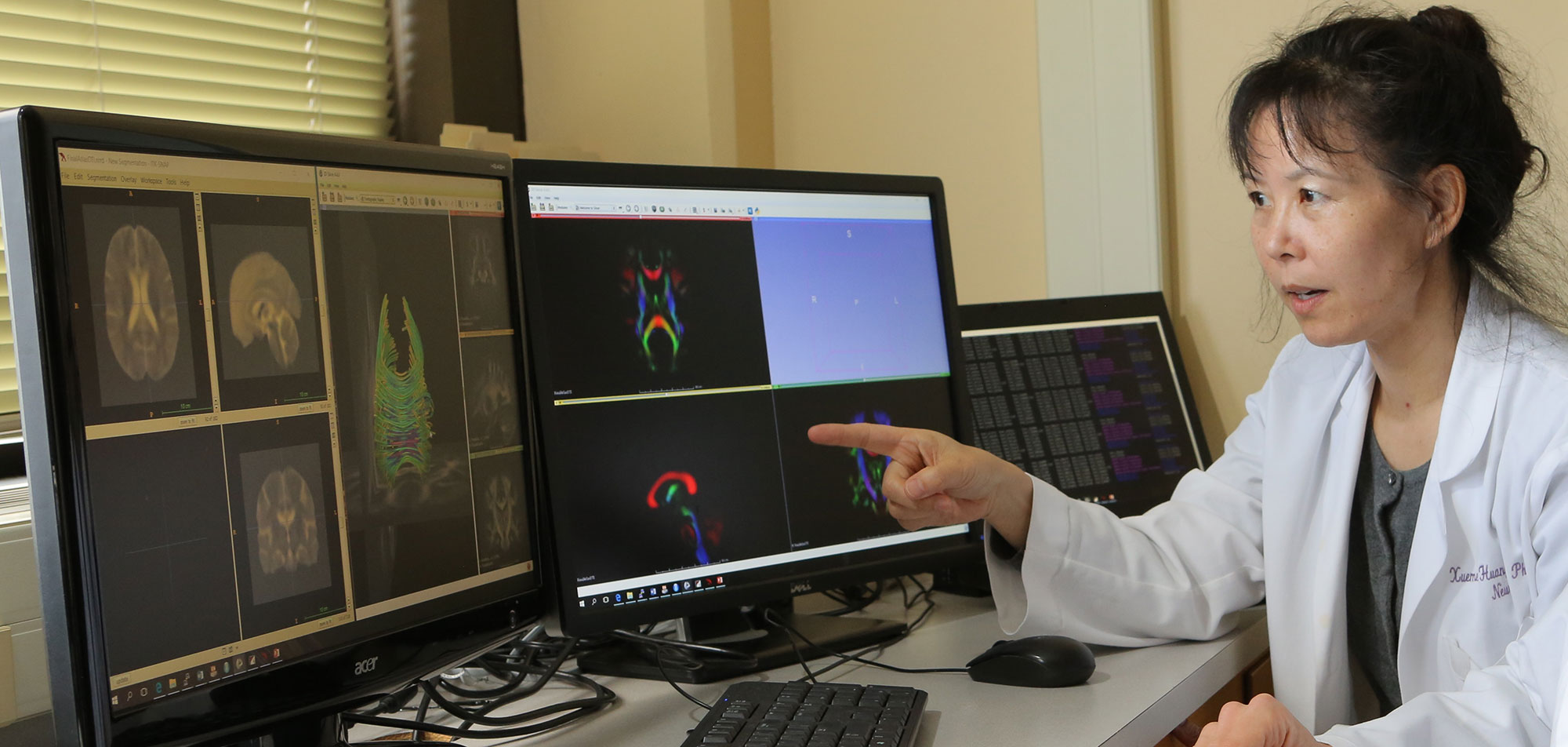 Dr. Xuemei Wang, Distinguished Professor and Vice Chair for Research in the Department of Neurology at Penn State College of Medicine, gestures toward a computer screen with images of a brain on it.